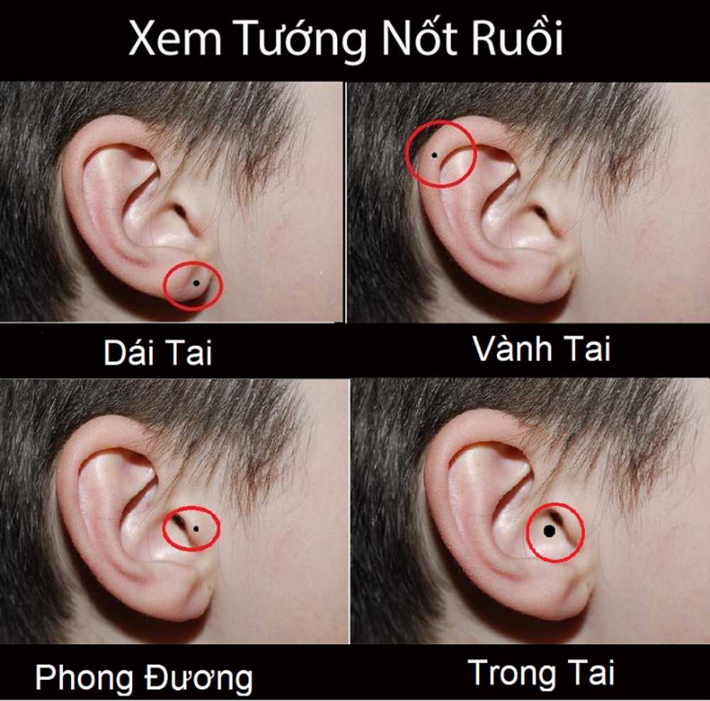 01111221 not ruoi o tai 01111221 not ruoi o tai