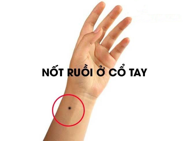 24175932 not ruoi o co tay 24175932 not ruoi o co tay