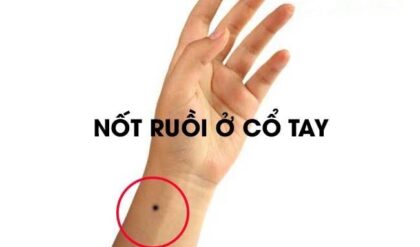 Not ruoi o co tay Phai Trai cua Nam va Not ruoi o co tay Phai Trai cua Nam va