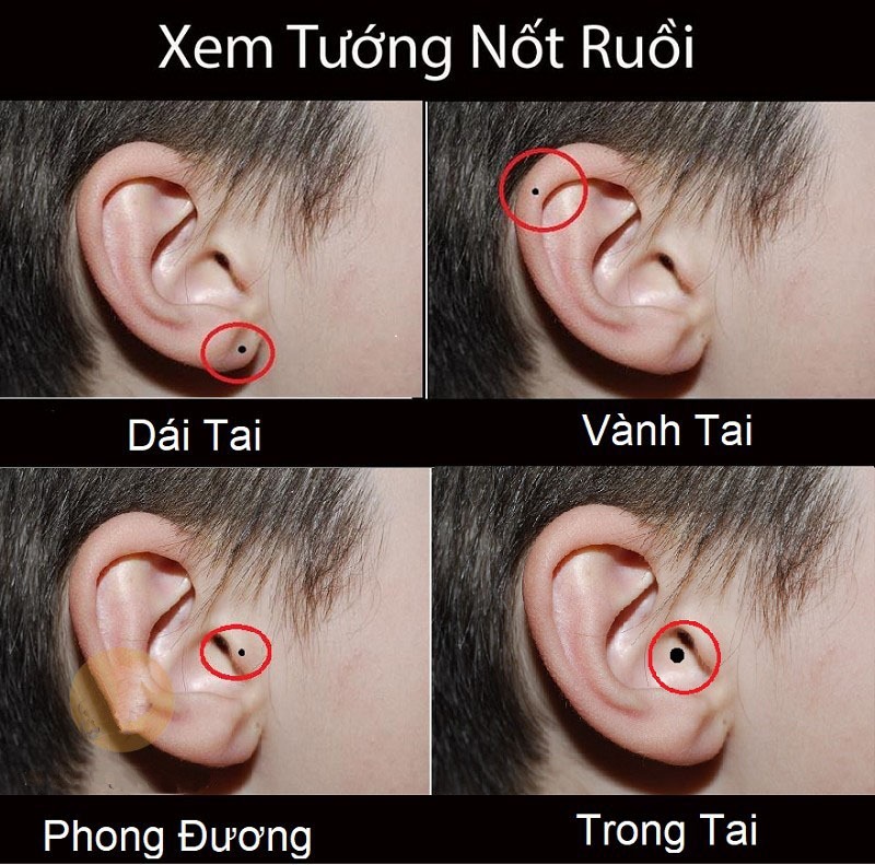 06224909 not ruoi o cuong tai 06224909 not ruoi o cuong tai