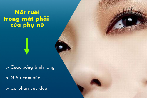 19085216 not ruoi trong mat phai cua phu nu 19085216 not ruoi trong mat phai cua phu nu