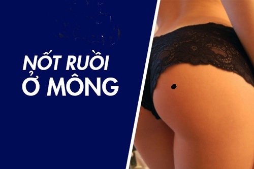 30105428 not ruoi o mong nam o eo hong trai 30105428 not ruoi o mong nam o eo hong trai